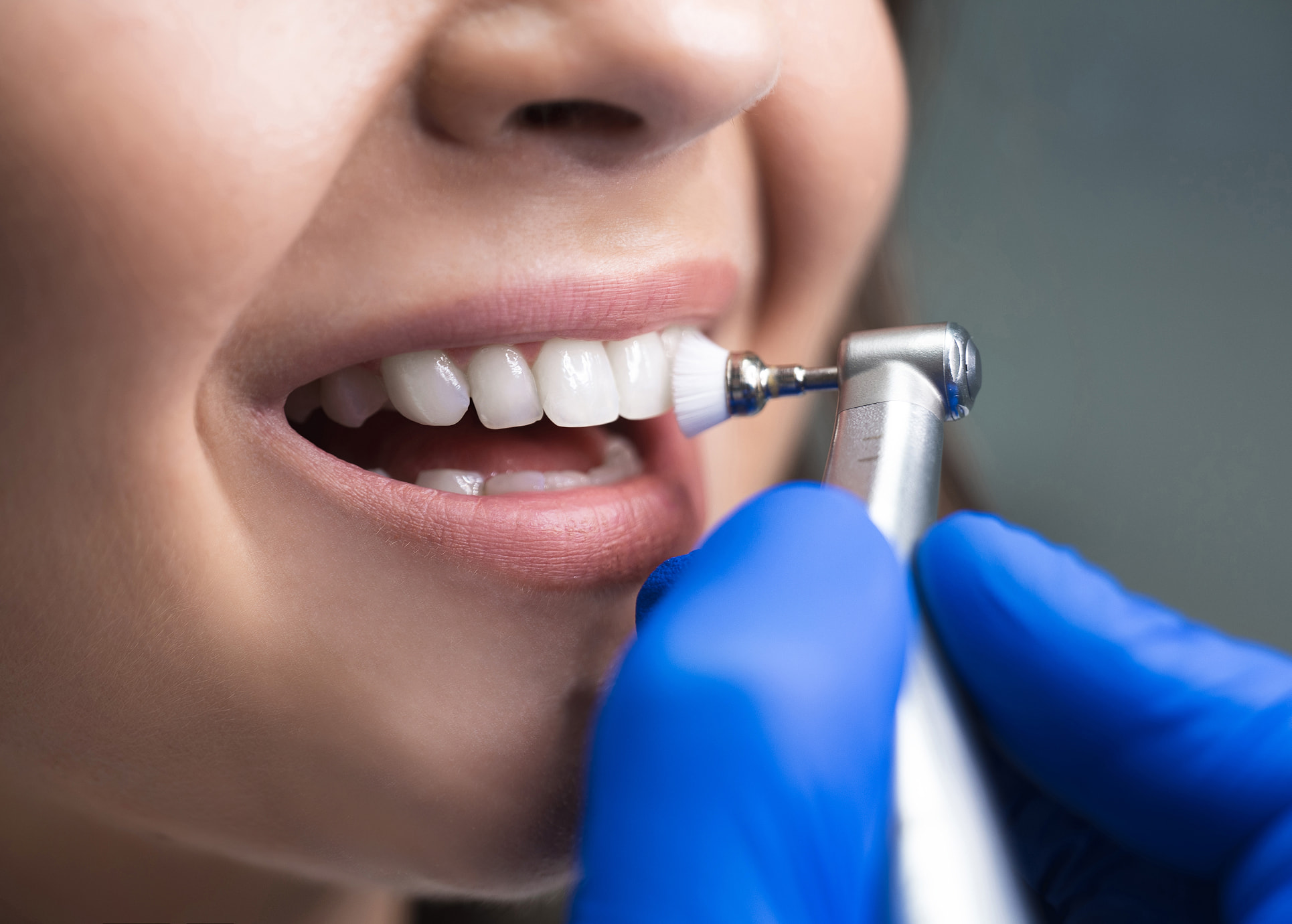 Preventive dental care and routine cleanings at Coastal Family Dentistry in Gulf Shores