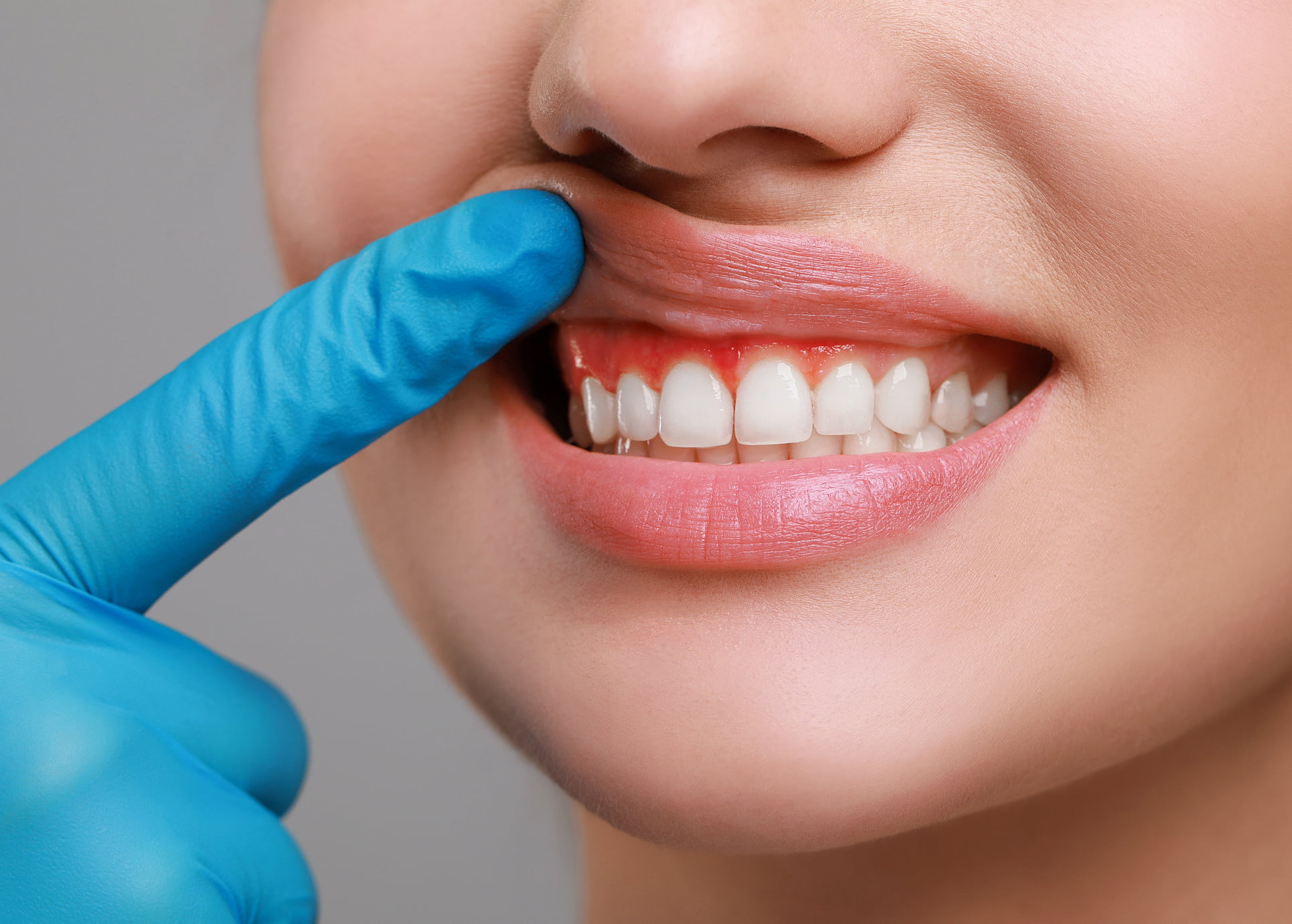 Gum disease prevention and treatment for healthy smiles